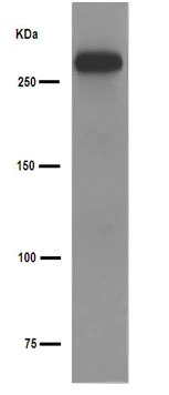 Western blot - Anti-SorLA/SORL1 antibody [EPR14670] (AB190684)