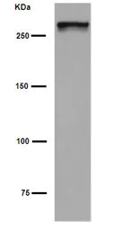 Western blot - Anti-SorLA/SORL1 antibody [EPR14670] (AB190684)