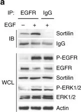 Western blot - Anti-Sortilin/NT3 antibody (AB16640)