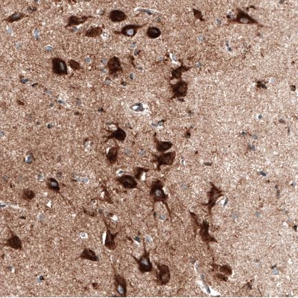 Immunohistochemistry (Formalin/PFA-fixed paraffin-embedded sections) - Anti-Sortilin/NT3 antibody [CL6526] (ab243043), expandable thumbnail