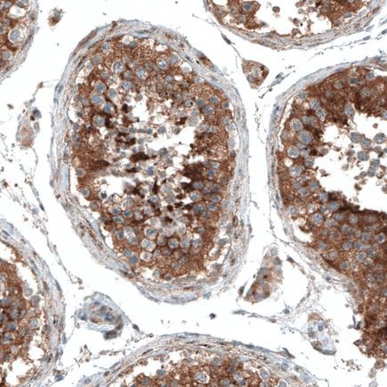 Immunohistochemistry (Formalin/PFA-fixed paraffin-embedded sections) - Anti-Sortilin/NT3 antibody [CL6526] (ab243043), expandable thumbnail