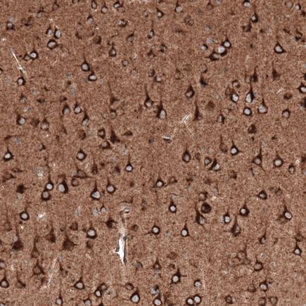 Immunohistochemistry (Formalin/PFA-fixed paraffin-embedded sections) - Anti-Sortilin/NT3 antibody [CL6526] (AB243043), expandable thumbnail