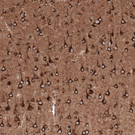 Immunohistochemistry (Formalin/PFA-fixed paraffin-embedded sections) - Anti-Sortilin/NT3 antibody [CL6526] (AB243043)