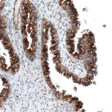 Immunohistochemistry (Formalin/PFA-fixed paraffin-embedded sections) - Anti-Sortilin/NT3 antibody [CL6526] (ab243043), expandable thumbnail