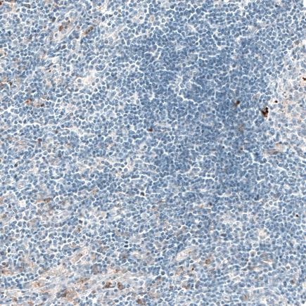 Immunohistochemistry (Formalin/PFA-fixed paraffin-embedded sections) - Anti-Sortilin/NT3 antibody [CL6526] (ab243043), expandable thumbnail