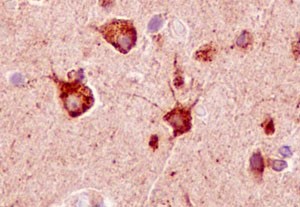 Immunohistochemistry (Formalin/PFA-fixed paraffin-embedded sections) - Anti-Sortilin/NT3 antibody [EPR15010] - Low endotoxin, Azide free (AB221785)