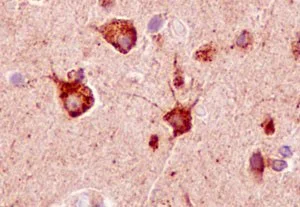 Immunohistochemistry (Formalin/PFA-fixed paraffin-embedded sections) - Anti-Sortilin/NT3 antibody [EPR15010] - Low endotoxin, Azide free (AB221785)