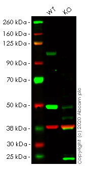 Western blot - Anti-Sortilin/NT3 antibody [EPR15010] - Low endotoxin, Azide free (AB221785)