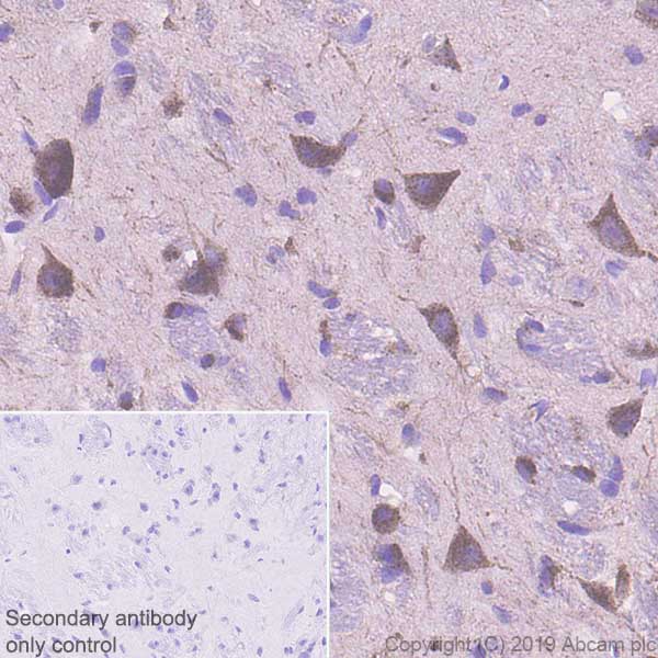 Immunohistochemistry (Formalin/PFA-fixed paraffin-embedded sections) - Anti-Sortilin/NT3 antibody [EPR23093-58] (ab263864), expandable thumbnail