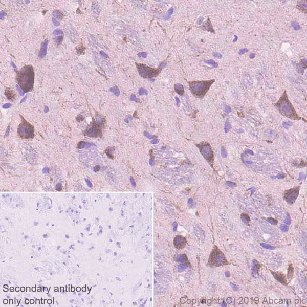 Immunohistochemistry (Formalin/PFA-fixed paraffin-embedded sections) - Anti-Sortilin/NT3 antibody [EPR23093-58] (AB263864)
