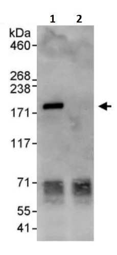Immunoprecipitation - Anti-SOS1 antibody (AB245645)