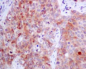 Immunohistochemistry (Formalin/PFA-fixed paraffin-embedded sections) - Anti-SOS1 antibody [EPR7480] (AB140621)