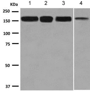 Western blot - Anti-SOS1 antibody [EPR7480] (AB140621)