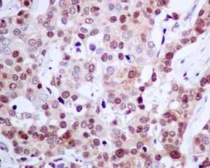 Immunohistochemistry (Formalin/PFA-fixed paraffin-embedded sections) - Anti-SOS1 antibody [EPR7480] - BSA and Azide free (AB248908)