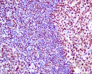 Immunohistochemistry (Formalin/PFA-fixed paraffin-embedded sections) - Anti-SOS1 antibody [EPR7480] - BSA and Azide free (AB248908)