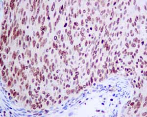 Immunohistochemistry (Formalin/PFA-fixed paraffin-embedded sections) - Anti-SOS1 antibody [EPR7480] - BSA and Azide free (ab248908), expandable thumbnail