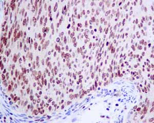Immunohistochemistry (Formalin/PFA-fixed paraffin-embedded sections) - Anti-SOS1 antibody [EPR7480] - BSA and Azide free (AB248908)