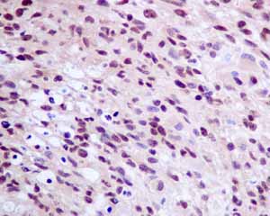 Immunohistochemistry (Formalin/PFA-fixed paraffin-embedded sections) - Anti-SOS1 antibody [EPR7480] - BSA and Azide free (ab248908), expandable thumbnail