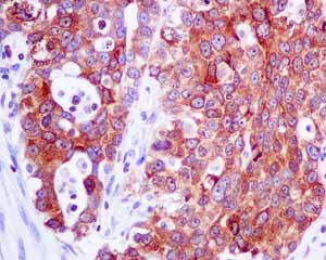 Immunohistochemistry (Formalin/PFA-fixed paraffin-embedded sections) - Anti-SOS1 antibody [EPR7480] - BSA and Azide free (AB248908)