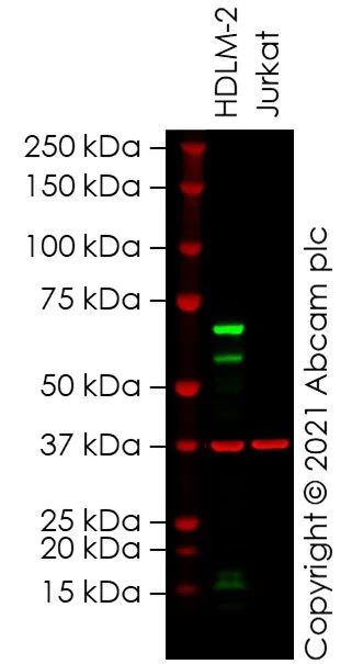 Western blot - Anti-SOS1 antibody [EPR7480] - BSA and Azide free (AB248908)