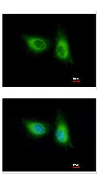Immunocytochemistry/ Immunofluorescence - Anti-SOS2 antibody (AB154999)