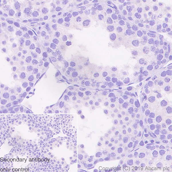 Immunohistochemistry (Formalin/PFA-fixed paraffin-embedded sections) - Anti-SOX1 antibody [EPR23041-60] (AB242125)