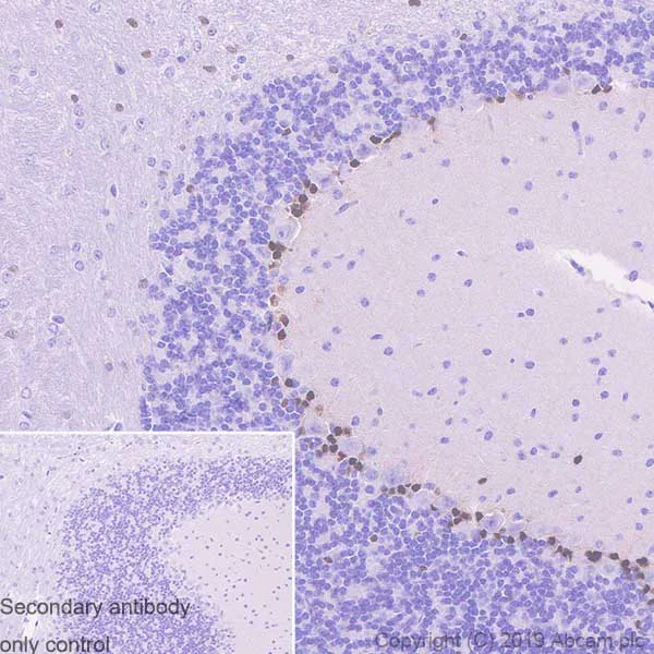 Immunohistochemistry (Formalin/PFA-fixed paraffin-embedded sections) - Anti-SOX1 antibody [EPR23041-60] (AB242125)