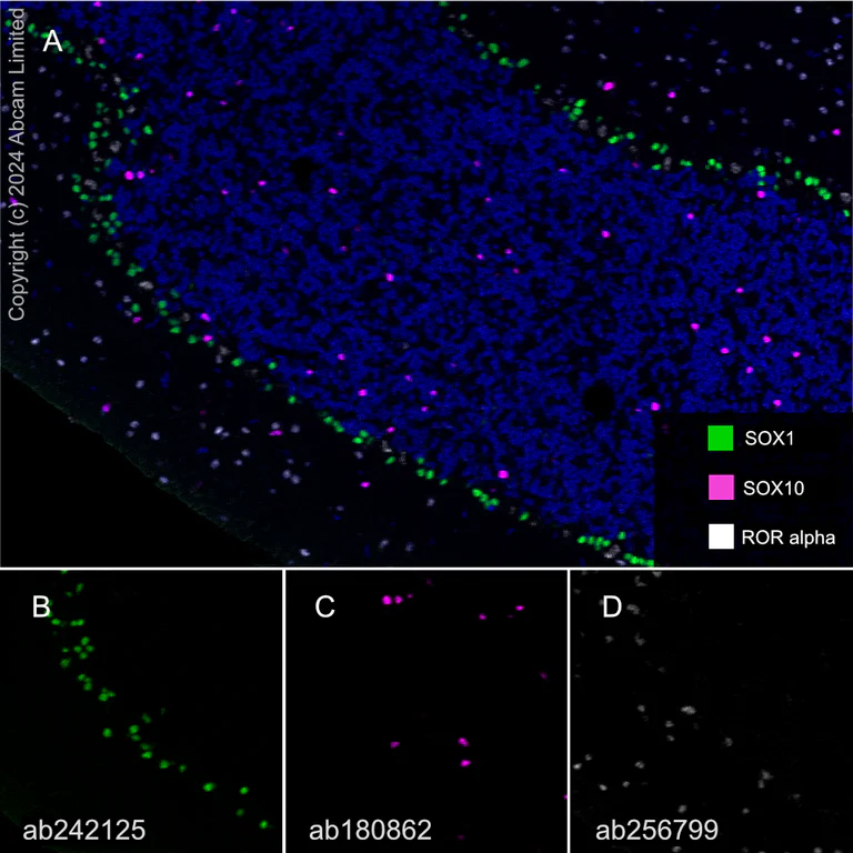 Multiplex immunohistochemistry - Anti-SOX1 antibody [EPR23041-60] (AB242125)