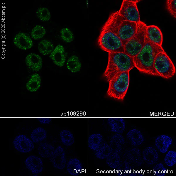 Immunocytochemistry/ Immunofluorescence - Anti-SOX1 antibody [EPR4766] - BSA and Azide free (AB227118)