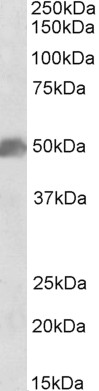 Western blot - Anti-SOX10 antibody (AB180228), expandable thumbnail