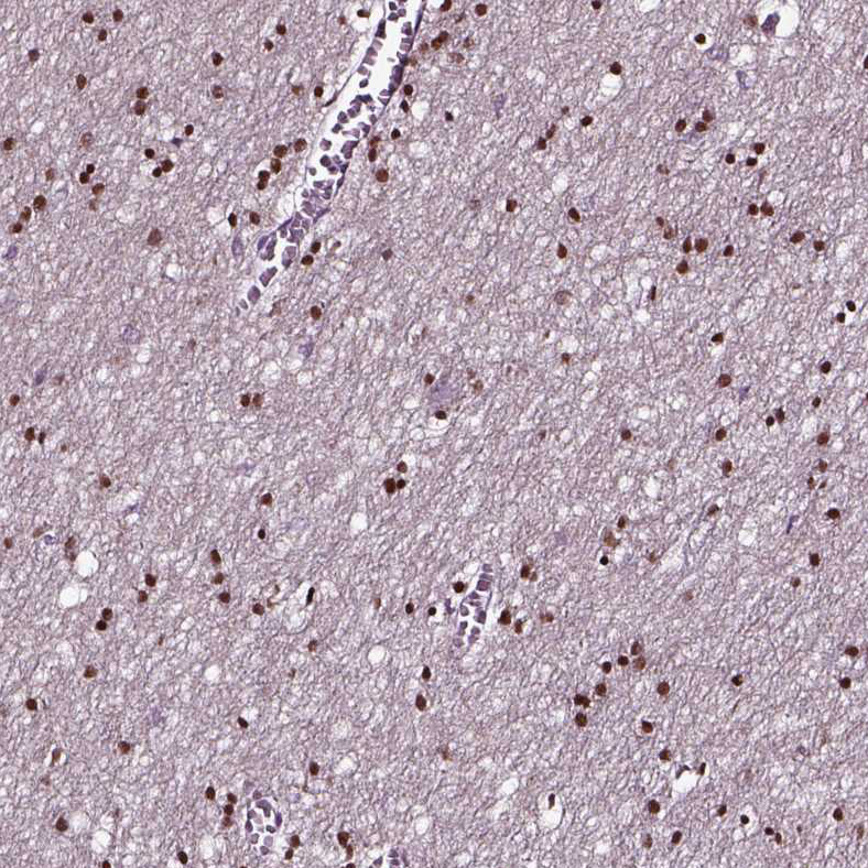 Immunohistochemistry (Formalin/PFA-fixed paraffin-embedded sections) - Anti-SOX10 antibody (AB221733), expandable thumbnail
