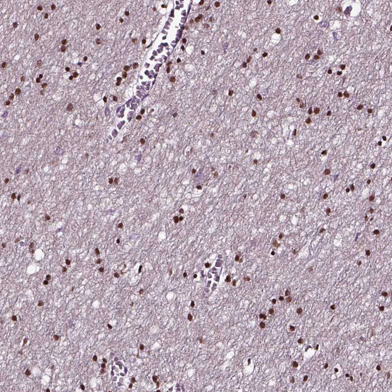 Immunohistochemistry (Formalin/PFA-fixed paraffin-embedded sections) - Anti-SOX10 antibody (AB221733)