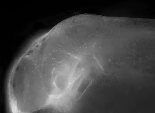 IHC - Wholemount - Anti-SOX10 antibody (AB229331)