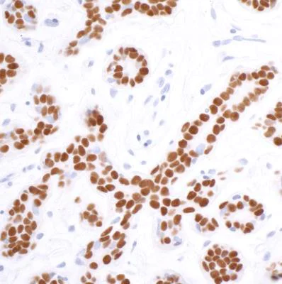 Immunohistochemistry (Formalin/PFA-fixed paraffin-embedded sections) - Anti-SOX10 antibody [BLR080G] (AB265587)