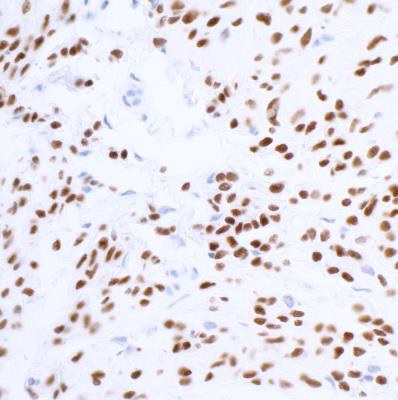 Immunohistochemistry (Formalin/PFA-fixed paraffin-embedded sections) - Anti-SOX10 antibody [BLR080G] (AB265587)