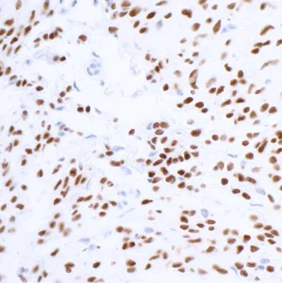 Immunohistochemistry (Formalin/PFA-fixed paraffin-embedded sections) - Anti-SOX10 antibody [BLR080G] (AB265587)
