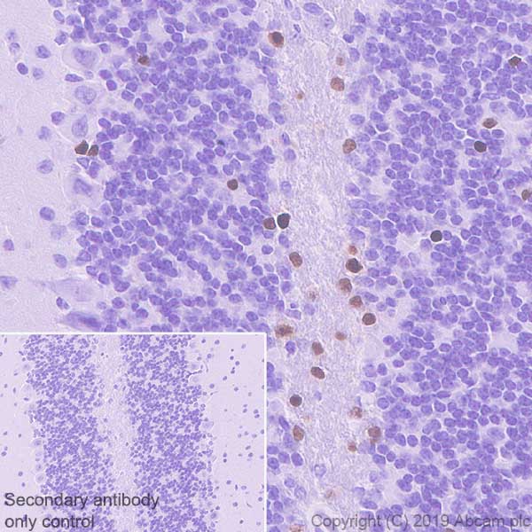 Immunohistochemistry (Formalin/PFA-fixed paraffin-embedded sections) - Anti-SOX10 antibody [EPR4007-104] (AB180862), expandable thumbnail