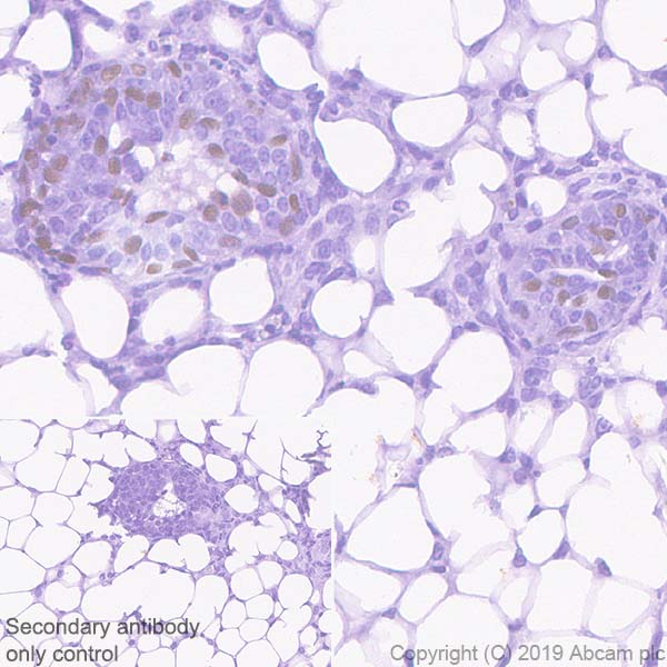Immunohistochemistry (Formalin/PFA-fixed paraffin-embedded sections) - Anti-SOX10 antibody [EPR4007-104] (AB180862), expandable thumbnail