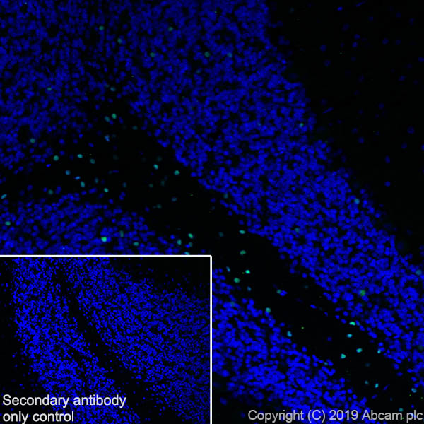Immunohistochemistry (Frozen sections) - Anti-SOX10 antibody [EPR4007-104] (AB180862), expandable thumbnail