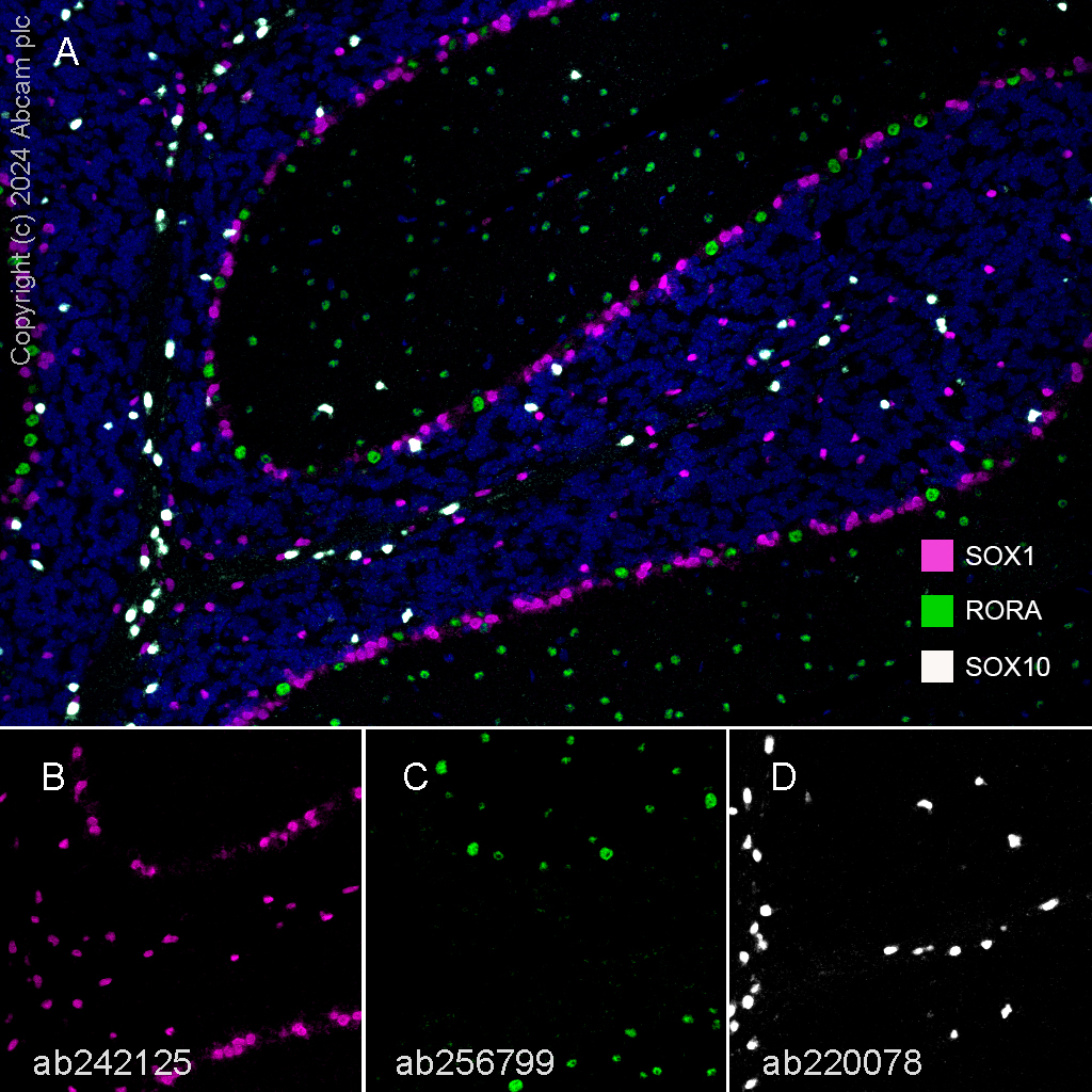 Multiplex immunohistochemistry - Anti-SOX10 antibody [EPR4007-104] (ab180862), expandable thumbnail