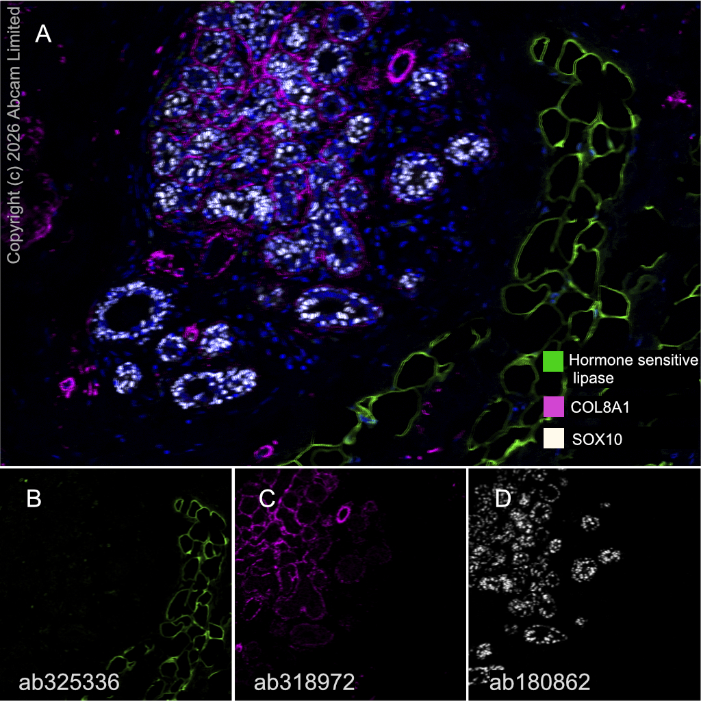 Multiplex immunohistochemistry - Anti-SOX10 antibody [EPR4007-104] (AB180862)