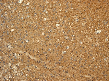 Immunohistochemistry (Formalin/PFA-fixed paraffin-embedded sections) - Anti-SOX10 antibody [EPR4007-104] - BSA and Azide free (AB220078)