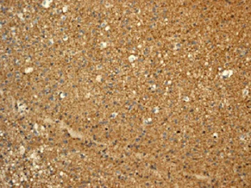 Immunohistochemistry (Formalin/PFA-fixed paraffin-embedded sections) - Anti-SOX10 antibody [EPR4007-104] - BSA and Azide free (AB220078)