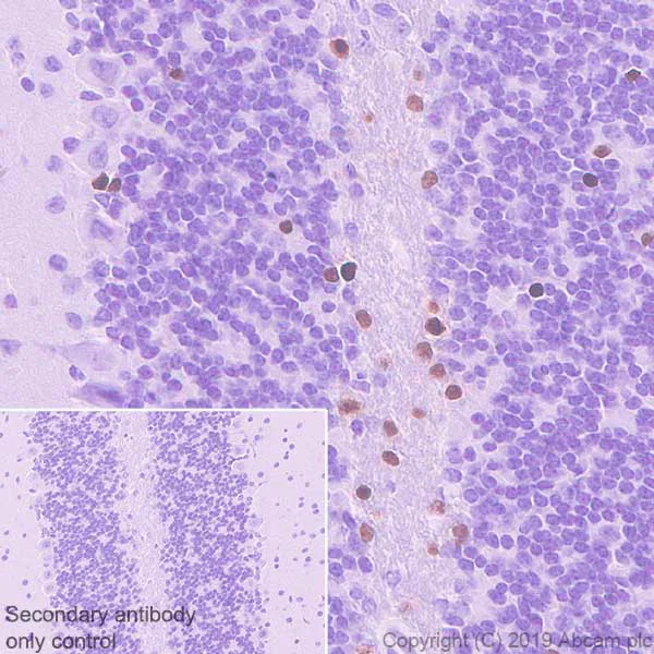 Immunohistochemistry (Formalin/PFA-fixed paraffin-embedded sections) - Anti-SOX10 antibody [EPR4007-104] - BSA and Azide free (AB220078)