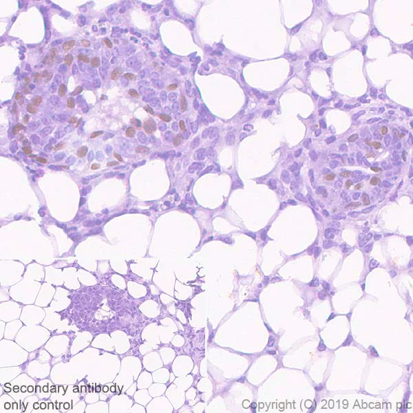 Immunohistochemistry (Formalin/PFA-fixed paraffin-embedded sections) - Anti-SOX10 antibody [EPR4007-104] - BSA and Azide free (AB220078)