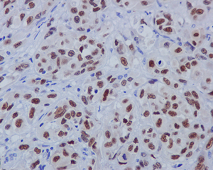 Immunohistochemistry (Formalin/PFA-fixed paraffin-embedded sections) - Anti-SOX10 antibody [EPR4007-104] - BSA and Azide free (AB220078)