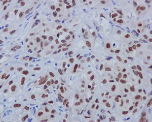 Immunohistochemistry (Formalin/PFA-fixed paraffin-embedded sections) - Anti-SOX10 antibody [EPR4007-104] - BSA and Azide free (AB220078)