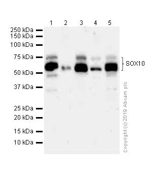 Western blot - Anti-SOX10 antibody [EPR4007] (AB155279)