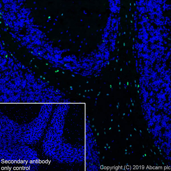 Immunohistochemistry (Frozen sections) - Anti-SOX10 antibody [EPR4007] - BSA and Azide free (AB186821), expandable thumbnail