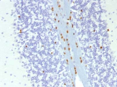 Immunohistochemistry (Formalin/PFA-fixed paraffin-embedded sections) - Anti-SOX10 antibody [SOX10/1074] (AB216020), expandable thumbnail